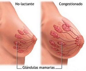 la-ingurgitacion-mamaria-e1398961641854