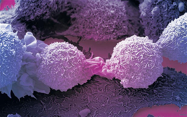Científicos ingleses descubren una proteína que puede acabar con todos los cáncer