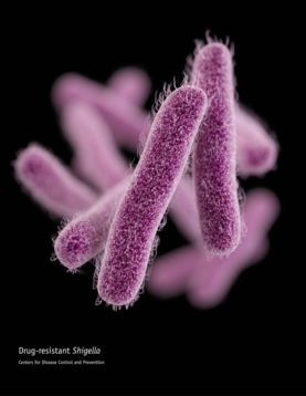 SHIGELLA SONNEI – Una superbacteria “muy contagiosa”,  genera terror