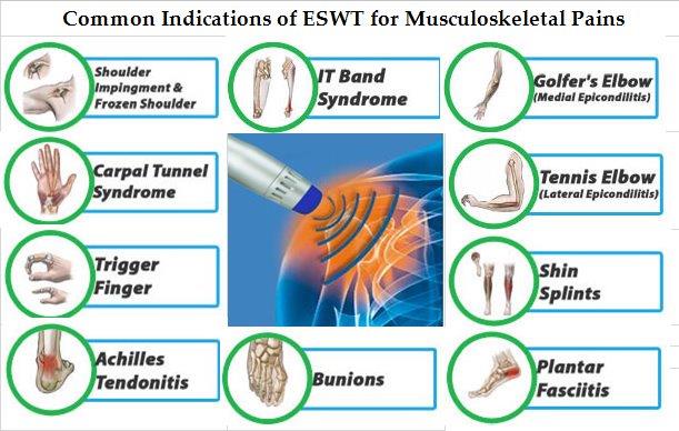 Shock Wave Therapy (ESWT)