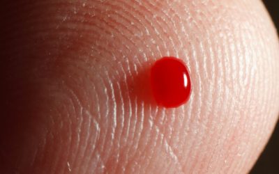 La biopsia líquida o Cómo saber si has vencido al cáncer en una gota de sangre