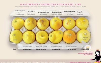 ‘Doce limones’ para detectar de forma rápida el cáncer de mama,