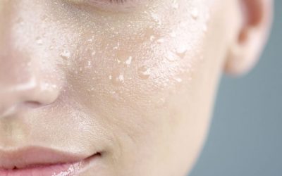 No esperes a tratar las marcas del acne (granos), acude lo antes posible al dermatólogo