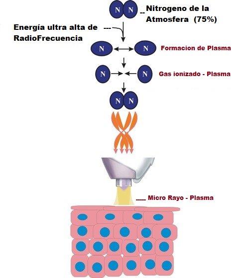 DGP de Plasm-A; Ionización del aire (Nitrógeno) 
