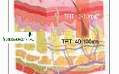 La importancia de la duración de pulso en los láseres y el tiempo de relajación termal TRT