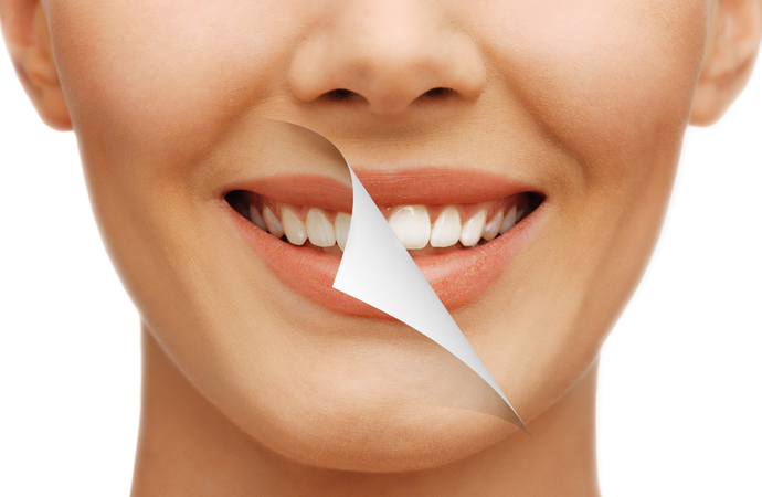 3 sencillas recomendaciones para mantener unos dientes blancos