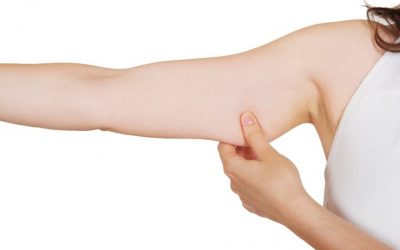 Algunos tratamientos para revertir la piel colgante de los brazos