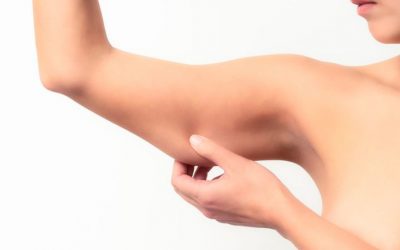 Cómo prevenir los brazos flácidos y arrugados